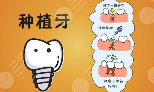 德國(guó)牙齒種植體品牌有哪些呢