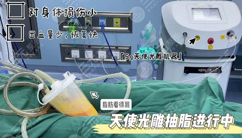 5g光雕吸脂