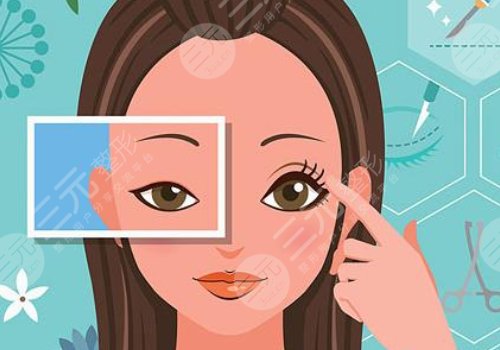 10個開內(nèi)眼角9個留疤怎么辦？怎么避免開眼角留疤？注意事項帶你了解！