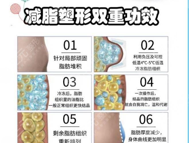 酷塑冷凍減脂