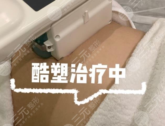 酷塑冷凍減脂
