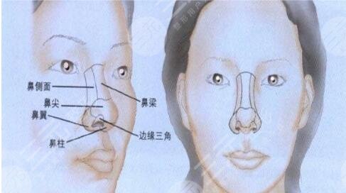 磨鼻骨10年后會怎么樣