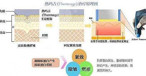 熱瑪吉