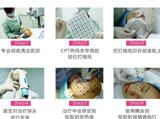 熱瑪吉