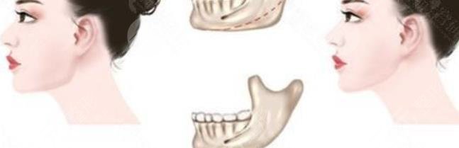 金一秀磨骨價(jià)格多少