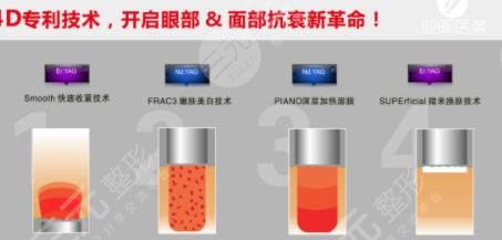 歐洲之星4d