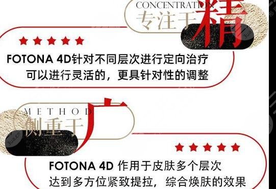 歐洲之星4d