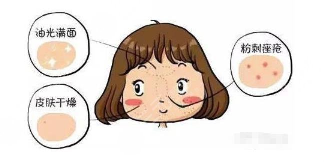 干貨分享|干皮vs油皮、油痘肌VS油敏肌，四者如何區(qū)分？怎么改良？