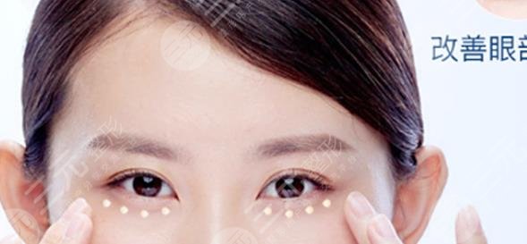 眼周小熨斗
