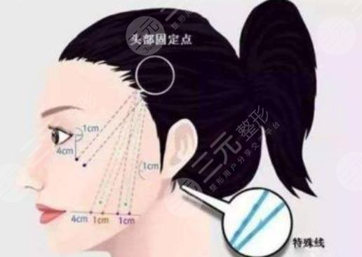 面部抗衰