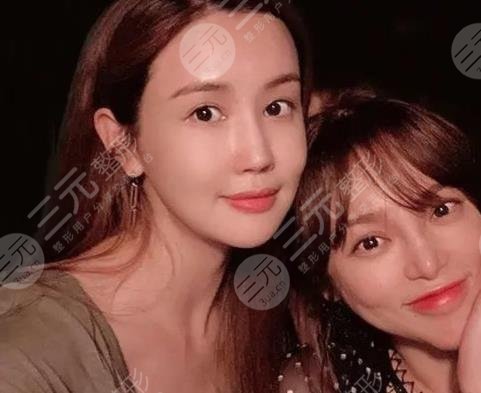 李多海整容多次變臉失敗？成韓國整形反面教材！盤點(diǎn)她的整容歷程
