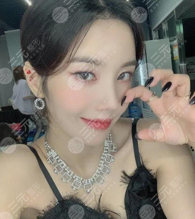 權(quán)恩妃整容了？solo近照公開神似裴珠泫Irene？她整了那些地方？