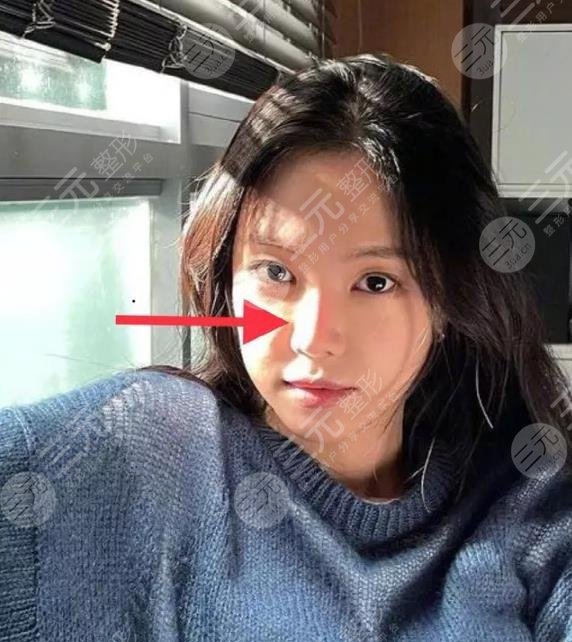孫娜恩近照鼻子透光被網(wǎng)友熱議整容失敗？Apink門面就此隕落！