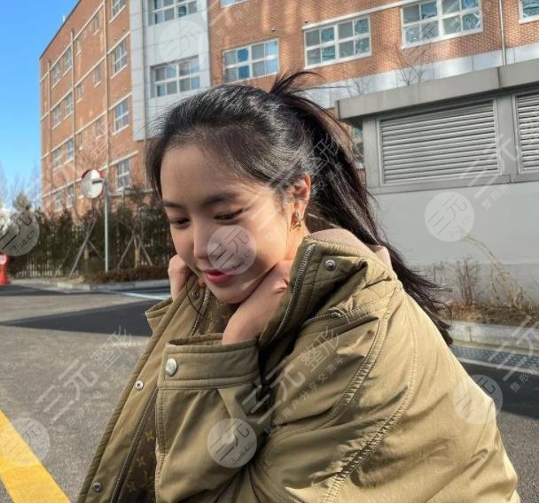 前Apink門面近照鼻子透光疑似整容失敗?
