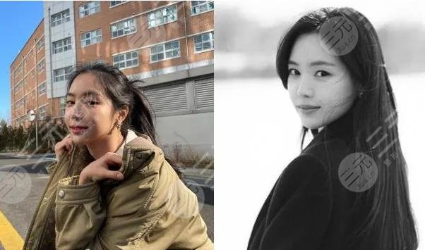 前Apink門面近照鼻子透光疑似整容失敗?