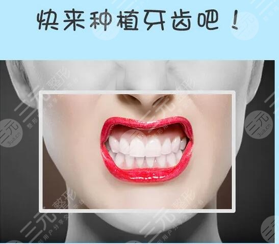種植牙的過程是怎樣的?