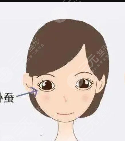 簡(jiǎn)單有去眼袋方法|內(nèi)切去眼袋恢復(fù)果圖分享