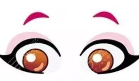 全切扇形雙眼皮恢復(fù)6個月很好看喲~