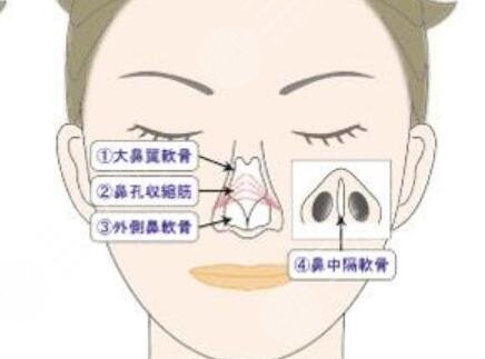 假體隆鼻好嗎 我做了假體隆鼻來看看