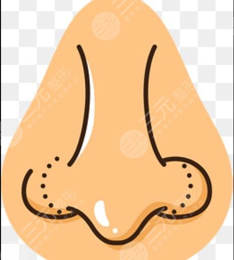 王會(huì)勇隆鼻失敗修復(fù)案例三個(gè)月恢復(fù)對(duì)比圖果分享