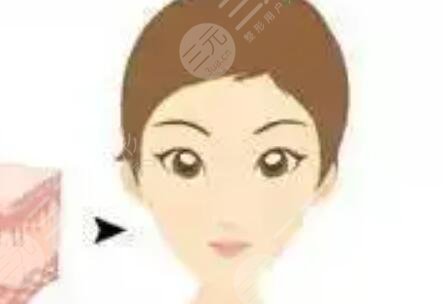 怎么變,v型,小臉,手術,恢復,過程,揭秘