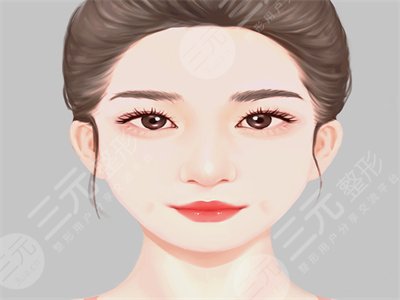 人造酒窩,手術(shù),恢復,過程,前后,果,對比,圖片,案例,分享