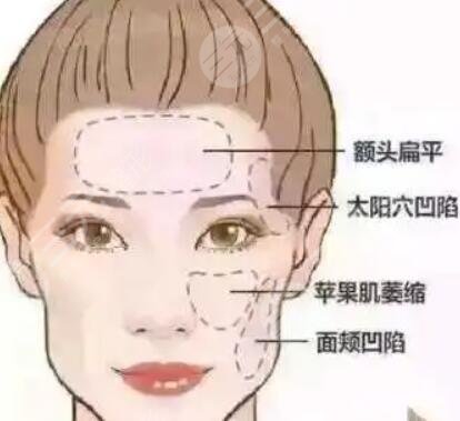 抗衰做拉皮好還是做提升抗皺好