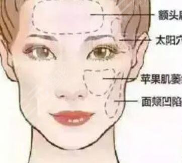 斯美諾整形面b提升怎樣？術(shù)后果對(duì)比反饋