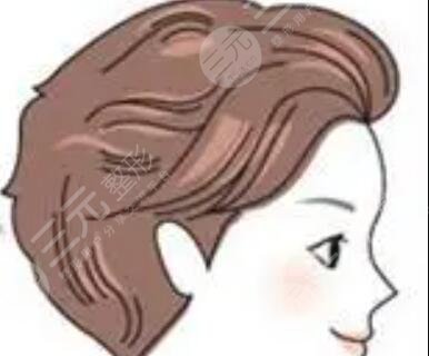 成都艾米麗醫(yī)院植發(fā)怎么樣？發(fā)際線果對(duì)比分享