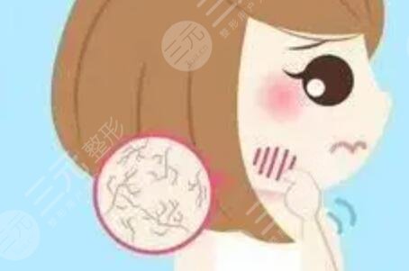 成都天之美整形怎么樣？激光祛紅血絲果反饋