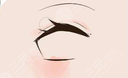 成都艾米麗眼部整形怎么樣？潘宏偉雙眼皮修復案例分享