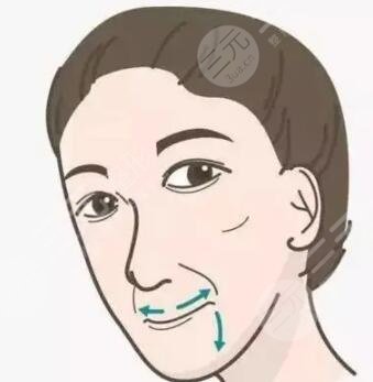 蘇州美貝爾整形水平如何？誠享隆鼻術(shù)后變美日記