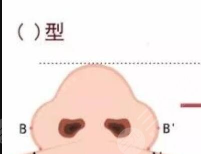 成都嬌點整形實力如何？自體隆鼻整形果對比