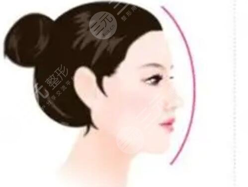 成都嬌點整形實力如何？自體隆鼻整形果對比