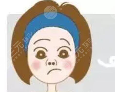 四川晶膚整形果好？誠意分享假體隆鼻術后驚艷對比