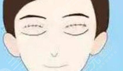 華西李正勇雙眼皮做的好不？雙眼皮圖片分享，變美就是這么簡(jiǎn)單~