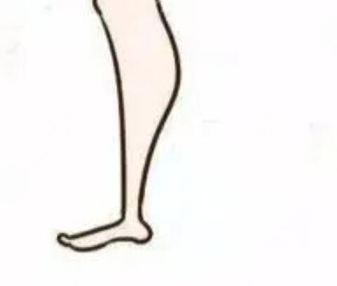 吸脂減肥真人案例 大腿吸脂親身經(jīng)歷