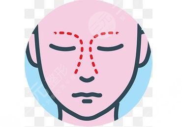 [種草]中山二院張金明案例：隆鼻失敗修復(fù)，重新?lián)碛辛Ⅲw感~