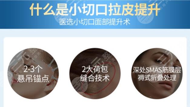 拉皮手術(shù)需要多少錢？