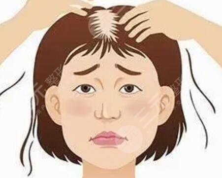 貴陽(yáng)口碑植發(fā)醫(yī)院案例