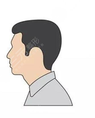 廣州中山一院植發(fā)掛什么科
