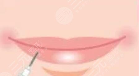 漂唇恢復(fù)七天過程圖，附個(gè)人漂唇經(jīng)歷過程圖片