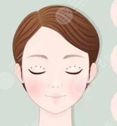 劉立強(qiáng)雙眼皮修復(fù)案例