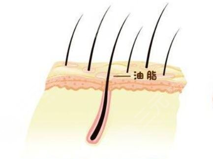 南京新生植發(fā)靠譜嗎？附發(fā)際線植發(fā)的真實(shí)經(jīng)歷