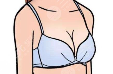深圳科美麗格胸部整形價格表|假體隆胸真實案例分享