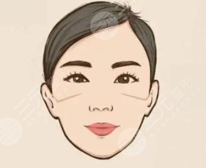 武漢新至美整形價格表|隆下頜真實(shí)案例立現(xiàn)鵝蛋臉