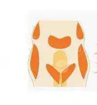 張一鳴個(gè)人資料簡(jiǎn)介，附上玻尿酸填充案例