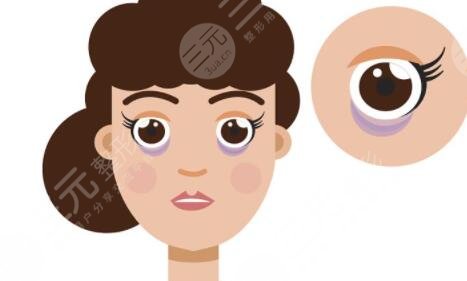 貴州省人民醫(yī)院外切眼袋手術(shù)案例，讓愛美者快速去眼袋