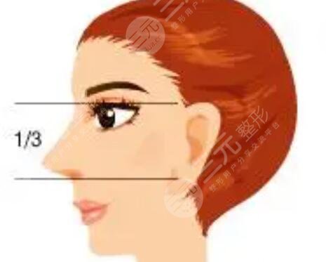 真人案例圖來(lái)嘍，看看隆鼻手術(shù)1-7天分別是什么樣子？