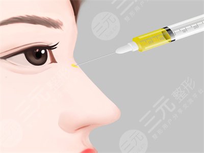 隆鼻恢復(fù)需要多久？恢復(fù)過程圖片真人展示~